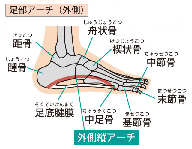足底筋膜炎とは
