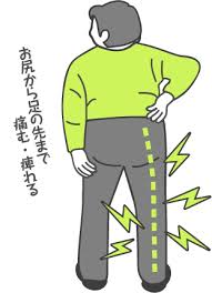 坐骨神経痛とは?